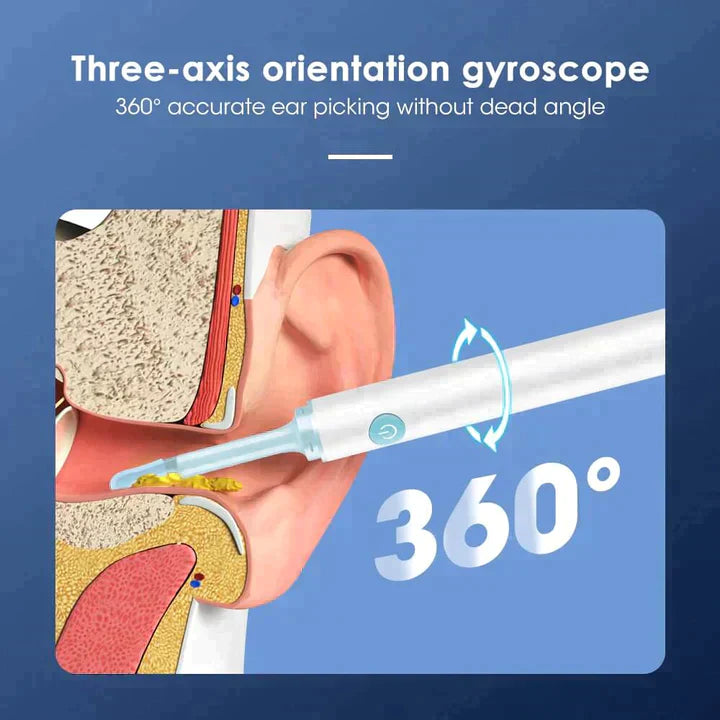 ASTRALUXCO™ - EAR WAX REMOVER PRO